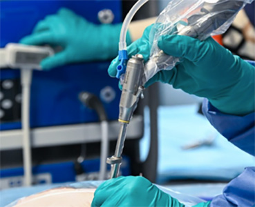 endoscope chirurgical